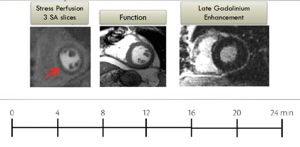 Fast Ischemia Protocol
